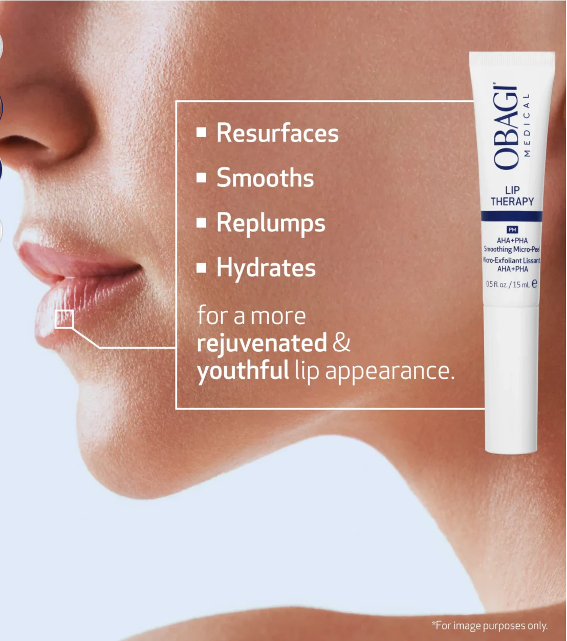 Lip Smoothing Micro Peel - Image 4
